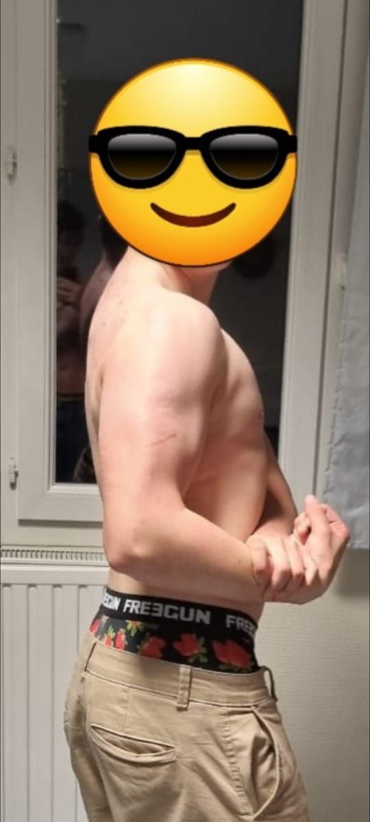 Profil de Yrieix